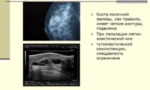 Какие народные средства для лечения кисты молочной железы в домашних условиях самые эффективные?